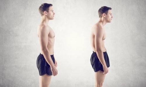 postur-duzeltme-bursa